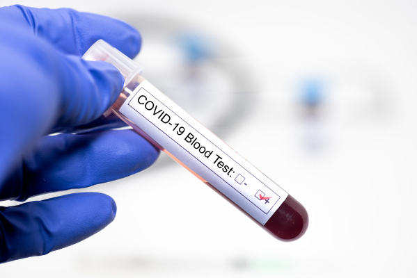 la_gomera_Test_coronavirus_2020 Colaboración ciudadana para proyecto que realizará más de 600 tests